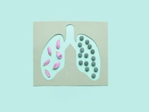 Какие виды пневмонии существуют? Можно ли сказать, что какие-либо из них более опасны для человека?