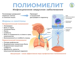 Роспотребнадзор напоминает о профилактике полиомиелита